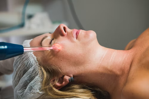 Limpeza de Pele Profunda com Peeling de Diamante - aprox. 2h