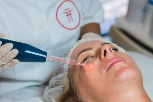 Limpeza de Pele Profunda com Peeling de Diamante - aprox. 2h